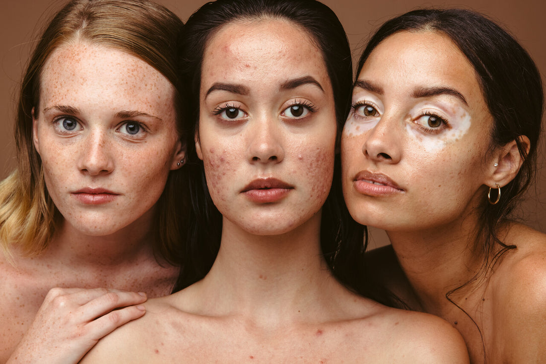 Why skin health looks different for everyone