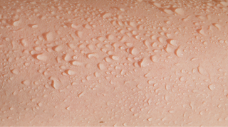 Why skin hydration is so important