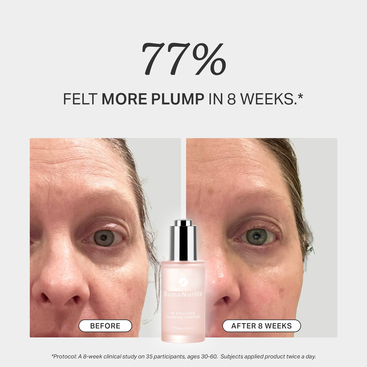 3D Collagen Plumping Complex 50ml
