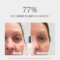 3D Collagen Plumping Complex 50ml