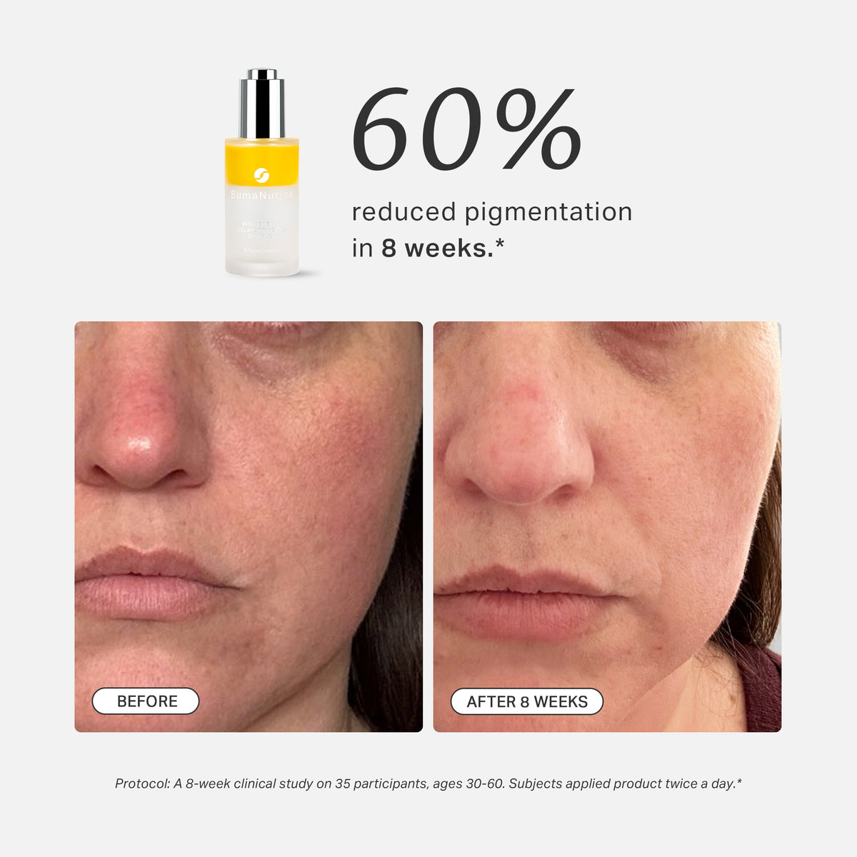 Bio-Renewal Azelaic Tripeptide Complex 50ml