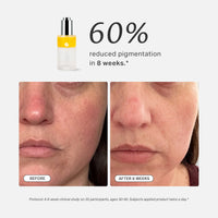 Bio-Renewal Azelaic Tripeptide Complex 50ml