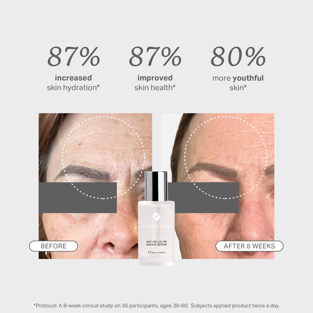 EGF Cellular Repair Serum 50ml