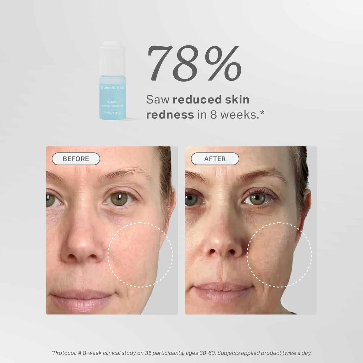 GHK-Cu Repairing Serum 30ml SumaNurica GHK-Cu Repairing Serum 30ml SumaNurica
