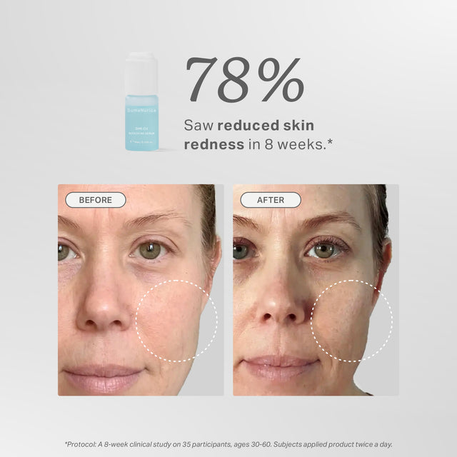 GHK-Cu Repairing Serum 30ml SumaNurica GHK-Cu Repairing Serum 30ml SumaNurica