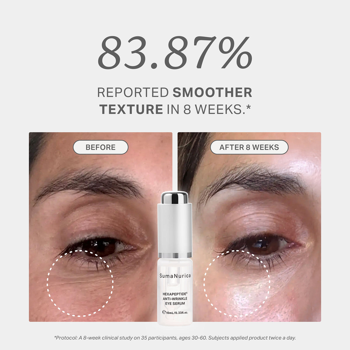 Hexapeptide5 Anti-Wrinkle Eye Serum 30ml