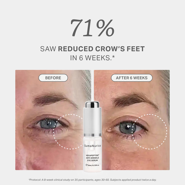 Hexapeptide5 Anti-Wrinkle Eye Serum 30ml