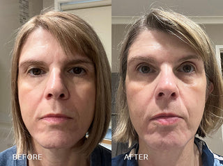 “My skin feels smoother and firmer after just two weeks.”