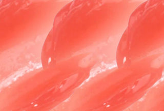 Superoxide Dismutase (SOD)